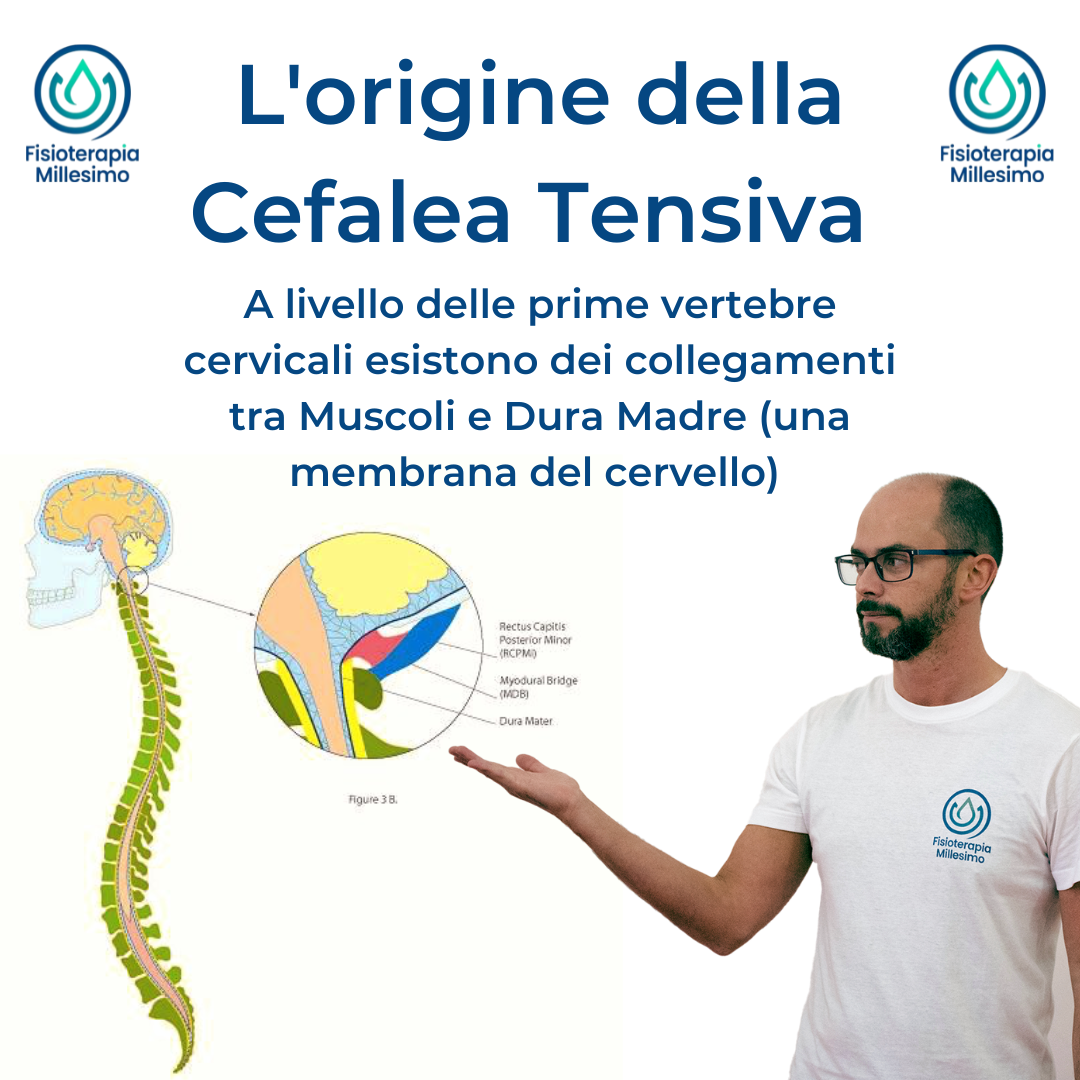 Bullone M6 Testa Svasata In Nichel Per Mobili - Fissaggi Per Letto E Pannelli Da Bolt World - Foto 2