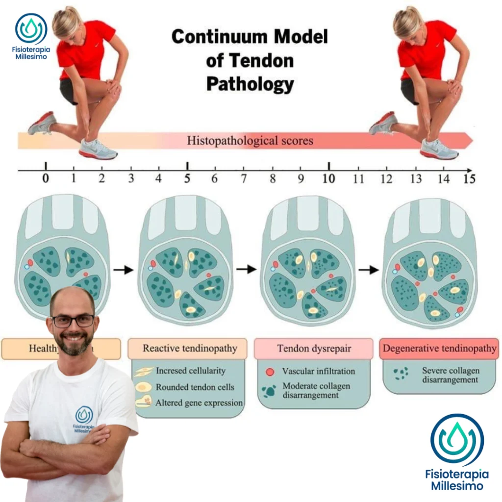 tendinite fisioterapia millesimo