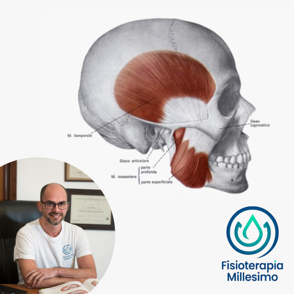 bruxismo 
mandibola
cefalea temporale
fisioterapia