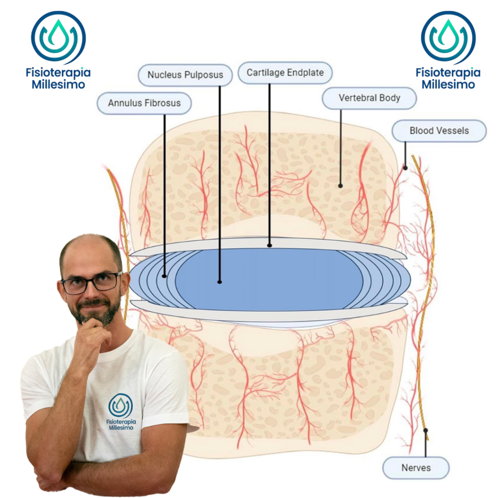 disco vertebrale, ernia del disco, lombalgia, fisioterapia per lombalgia, fisioterapia per mal di schiena