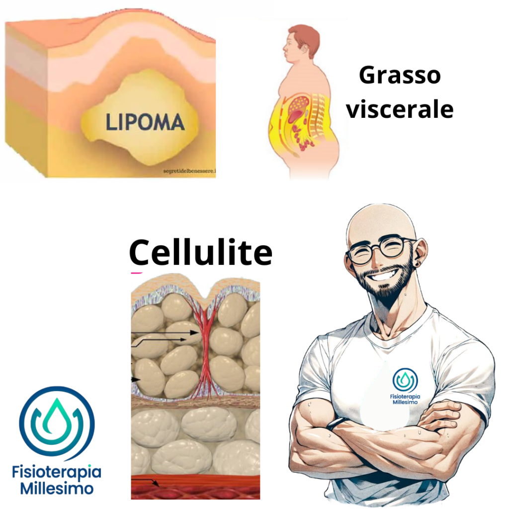 Cellulite lipoma e grasso viscerale